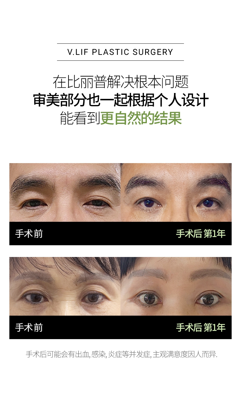 在比丽普解决根本问题 审美部分也一起根据个人设计 能看到更自然的结果 