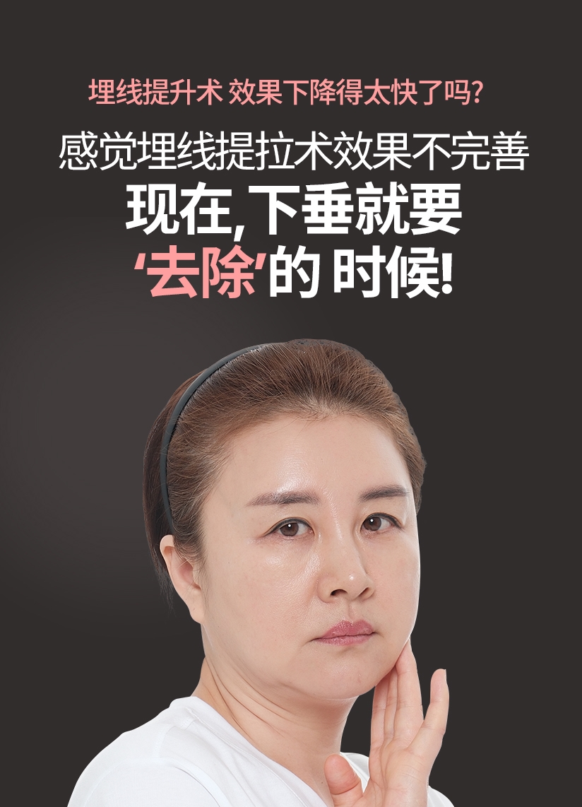 埋线提升术 效果下降得太快了吗？感觉埋线提拉术效果不完善 现在, 下垂就要 ‘去除’ 的 时候! 