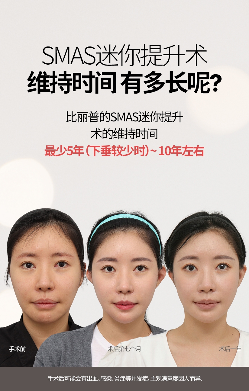 SMAS迷你提升术 维持时间 有多长呢? 比丽普的SMAS迷你提升术的维持时间 最少5年（下垂较少时）~ 10年左右 手术前 术后第七个月 术后一年 手术后可能会有出血, 感染, 炎症等并发症，主观满意度因人而异.