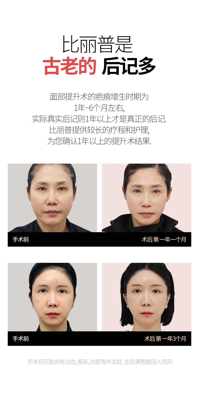 比丽普是 古老的 后记多 面部提升术的疤痕增生时期为1年~6个月左右, 实际真实后记则1年以上才是真正的后记. 比丽普提供较长的疗程和护理, 为您确认1年以上的提升术结果. 手术前 术后 第 一年一个月 手术前 术后 第 一年3个月 手术后可能会有出血, 感染, 炎症等并发症, 主观满意度因人而异.