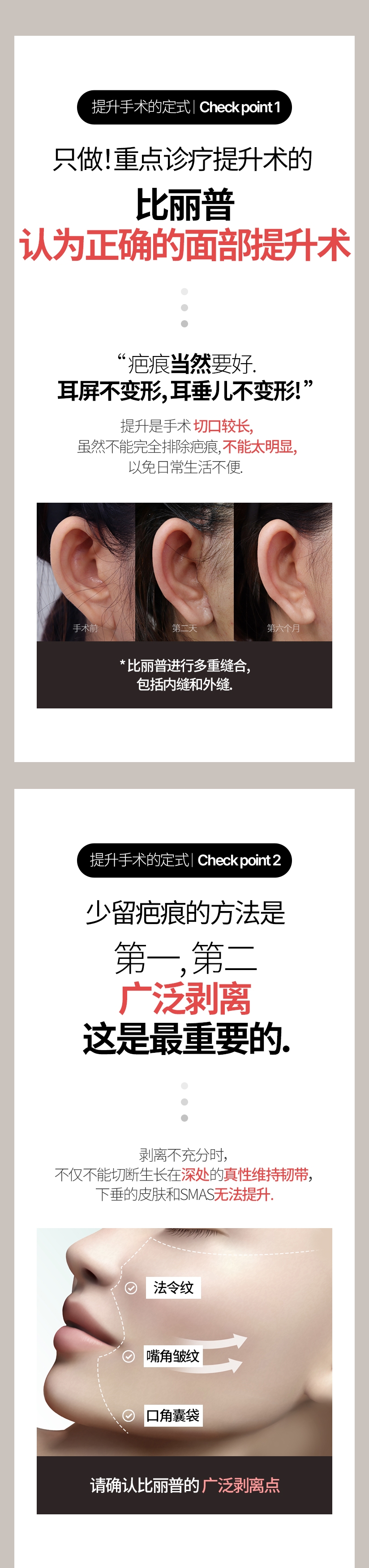 提升手术的定式  |  Check point  1  只做！重点诊疗提升术的 比丽普认为正确的面部提升术 “ 疤痕当然要好. 耳屏不变形, 耳垂儿不变形! ” 提升是手术 切口较长, 虽然不能完全排除疤痕, 不能太明显, 以免日常生活不便. 手术前 第二天 第六个月 * 比丽普进行多重缝合, 包括内缝和外缝. 提升手术的定式  |  Check point 2 少留疤痕的方法是 第一, 第二 广泛剥离 这是最重要的. 剥离不充分时, 不仅不能切断生长在深处的真性维持韧带 深处的 真性维持韧带 下垂的皮肤和SMAS无法提升. 法令纹 嘴角皱纹 口角囊袋 请确认比丽普的 广泛剥离点