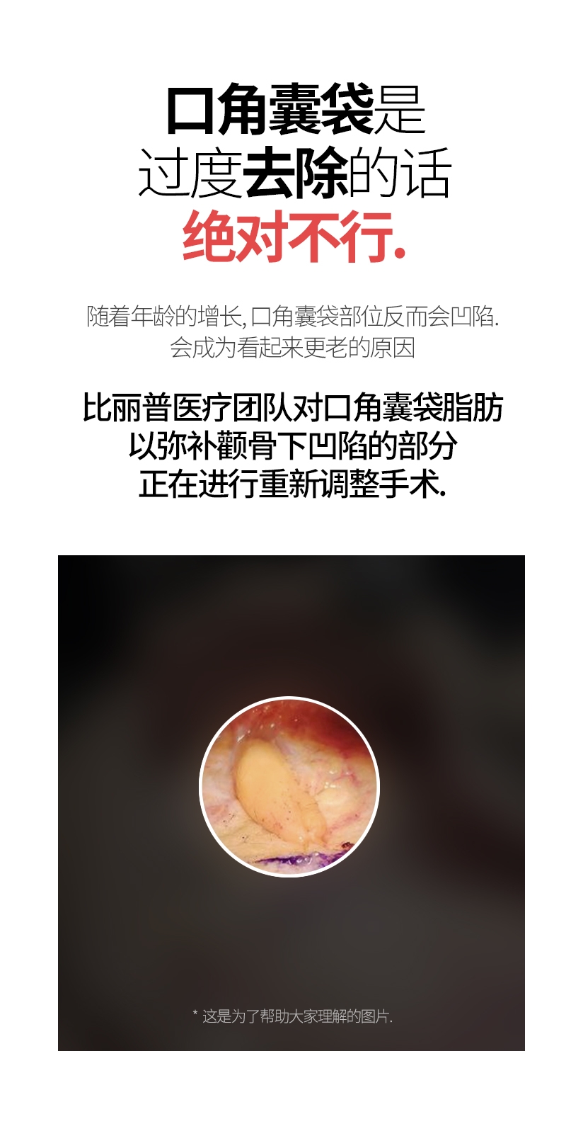 口角囊袋是  过度去除的话 绝对不行. 随着年龄的增长, 口角囊袋部位反而会凹陷. 会成为看起来更老的原因. 比丽普医疗团队对口角囊袋脂肪 以弥补颧骨下凹陷的部分 正在进行重新调整手术.