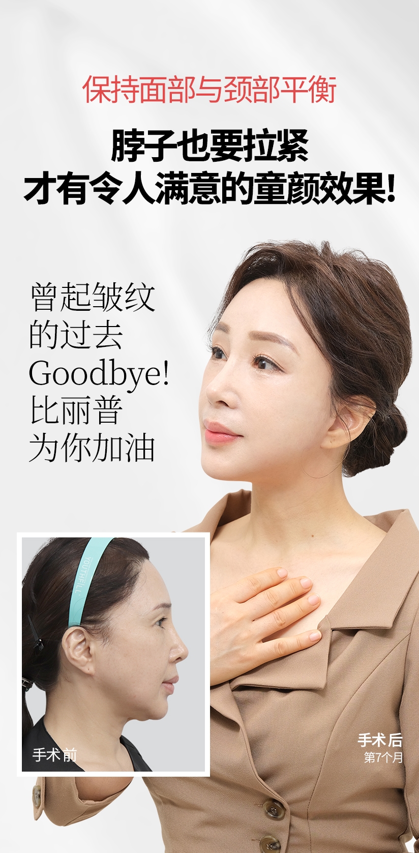 保持面部与颈部平衡 脖子也要拉紧 才有令人满意的童颜效果! 曾起皱纹的过去Goodbye!  比丽普为你加油 手术 前  手 术 后 第7个月 
