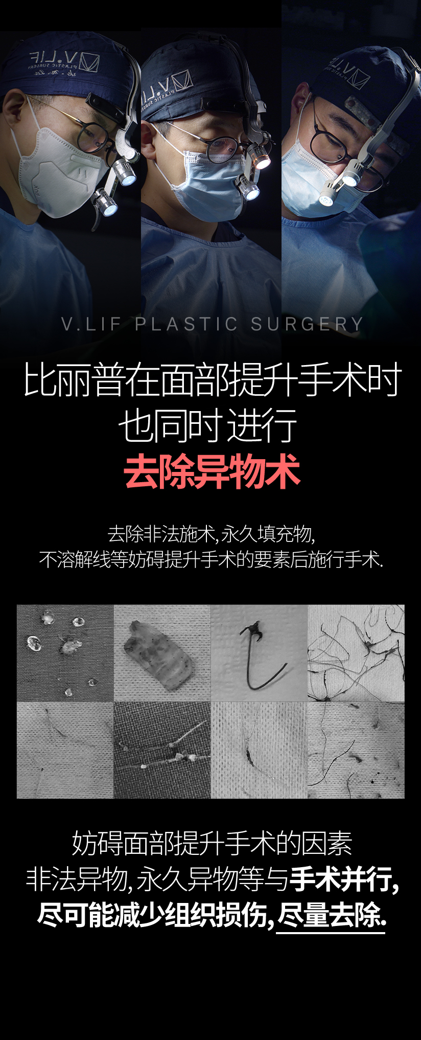 比丽普在面部提升手术时 也同时 进行 去除异物术 去除非法施术, 永久填充物, 不溶解线等妨碍提升手术的要素后施行手术. 妨碍面部提升手术的因素 非法异物, 永久异物等与手术并行, 尽可能减少组织损伤, 尽量去除.