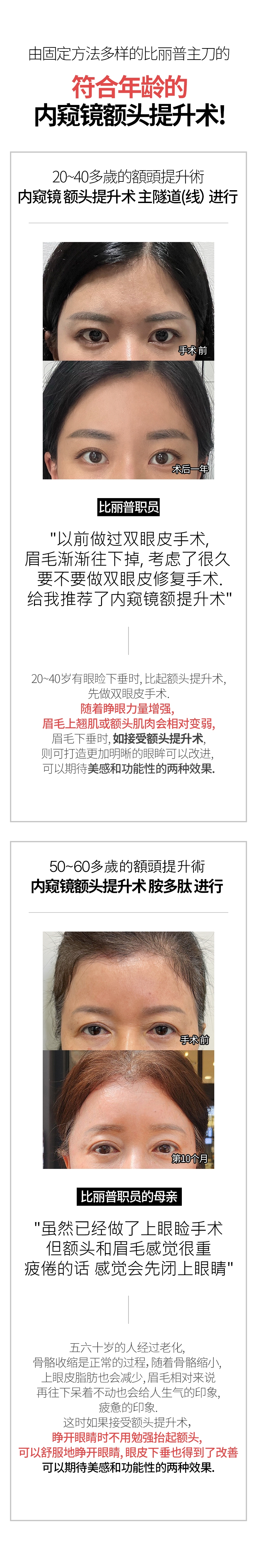 由固定方法多样的比丽普主刀的 符合年龄的 内窥镜额头提升术! 20~40多歲的額頭提升術 内窥镜 额头提升术 主隧道(线）进行 手术 前 术后一年 比丽普职员 以前做过双眼皮手术, 眉毛渐渐往下掉, 考虑了很久 要不要做双眼皮修复手术. 给我推荐了内窥镜额提升术 20~40岁有眼睑下垂时, 比起额头提升术, 先做双眼皮手术. 随着睁眼力量增强，眉毛上翘肌或额头肌肉会相对变弱, 眉毛下垂时, 如接受额头提升术, 则可打造更加明晰的眼眸 可以改进, 可以期待美感和功能性的两种效果.50~60多歲的額頭提升術 内窥镜额头提升术 胺多肽 进行 手术 前 第10个月 比丽普职员的母亲 虽然已经做了上眼睑手术 但额头和眉毛感觉很重 疲倦的话 感觉会先闭上眼睛 五六十岁的人经过老化，骨骼收缩是正常的过程，随着骨骼缩小，上眼皮脂肪也会减少，眉毛相对来说再往下呆着不动也会给人生气的印象、疲惫的印象. 这时如果接受额头提升术, 睁开眼睛时不用勉强抬起额头，可以舒服地睁开眼睛，眼皮下垂也得到了改善 可以期待美感和功能性的两种效果.