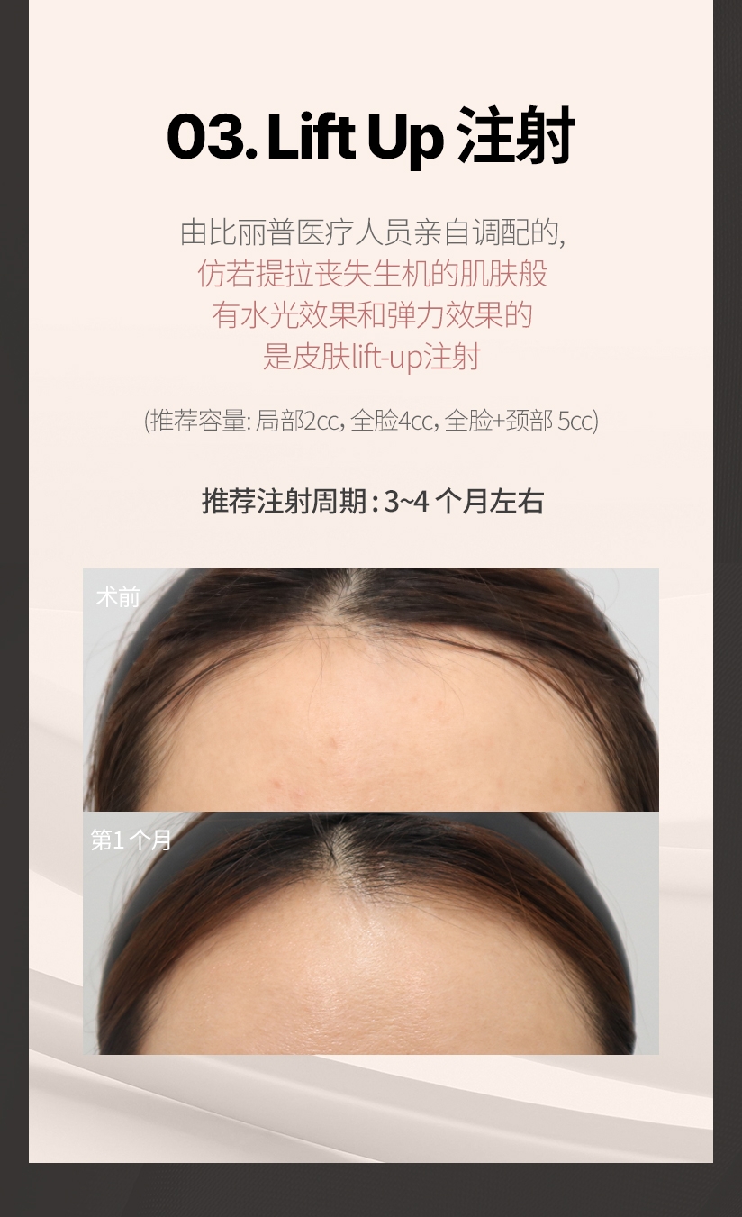 03. Lift Up 注射 由比丽普医疗人员亲自调配的 仿若提拉丧失生机的肌肤般 有水光效果和弹力效果的 是皮肤lift-up注射. (推荐容量 : 局部2cc, 全脸4cc, 全脸+颈部 5cc) 推荐注射周期 : 3~4 个月左右 