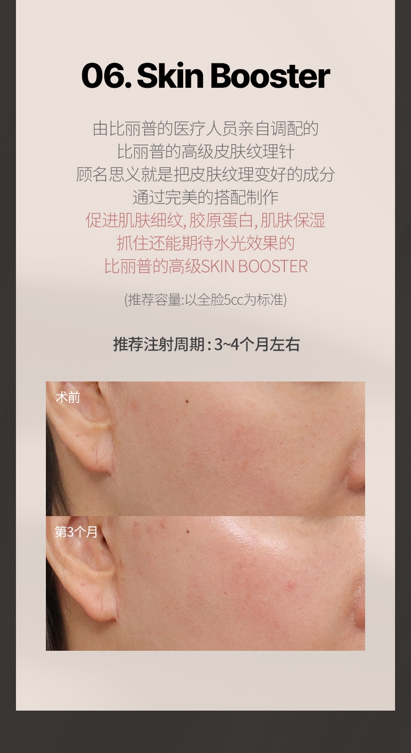 06. Skin Booster 由比丽普的医疗人员亲自调配的 比丽普的高级皮肤纹理针 顾名思义就是把皮肤纹理变好的成分 通过完美的搭配制作 促进肌肤细纹, 胶原蛋白, 肌肤保湿 抓住还能期待水光效果的 比丽普的高级SKIN BOOSTER (推荐容量 : 以全脸5cc为标准) 推荐注射周期 : 3~4个月左右 