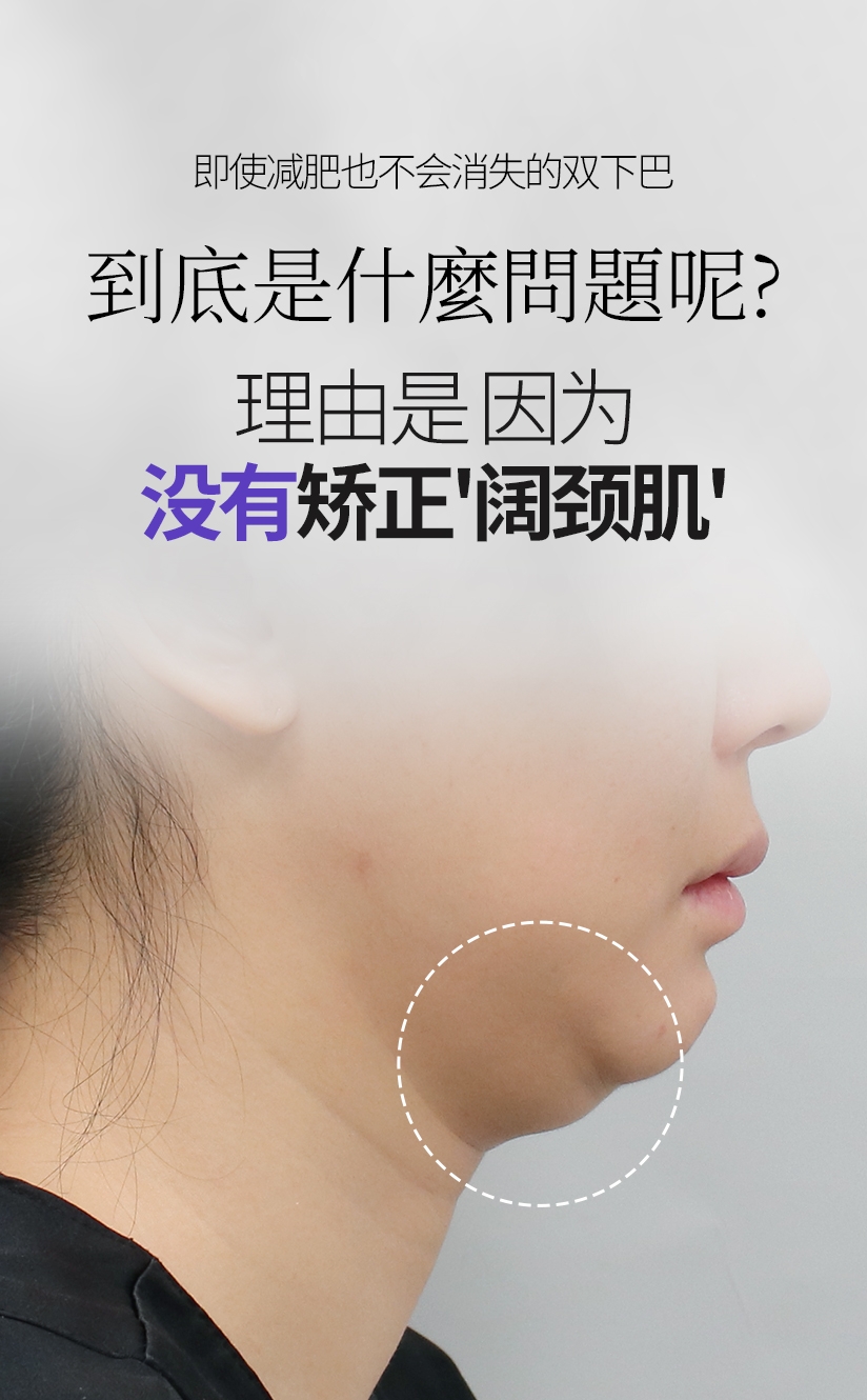 即使减肥也不会消失的双下巴 到底是什么问题呢? 理由是 因为 没有矫正'阔颈肌'